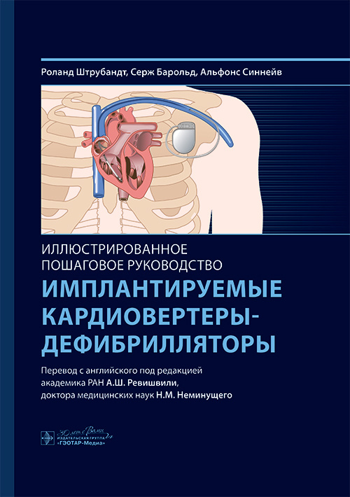 Имплантируемые кардиовертеры-дефибрилляторы. Иллюстрированное пошаговое руководство